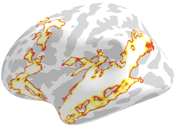 brain